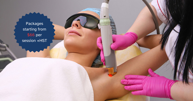 Laser Hair Removal